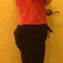 Swollen belly- day 1
