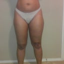 Hip & Thigh Before