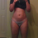 Hip & Thigh at 3 months after