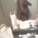 Side View without Garment takin on 2/26/2013 (1 day post op), bleeding has stopped, just swelling and pain still.