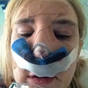 An hour after surgery. PAIN!