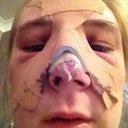 My nose is a mess