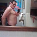 Pre-surgery