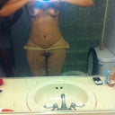 5 days post op
