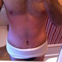 Post Op - Day 7 - One week down and swelling is improving.
