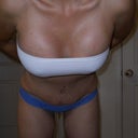 2 weeks post op - bent over front view