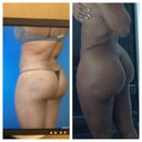 Post op surgery 1 and post op surgery 2