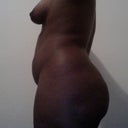 Pre op surgery 1