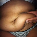 so much loose skin