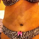 4weeks post op new me!