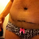 scar view
