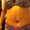 4wks post op