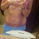 The yucky skin :(