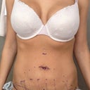 Surgeon's drawings