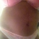 Stomach need to be lipo-ed