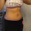 3.5 weeks post-op