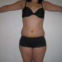 Front, 8 days post