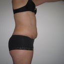 Side, 8 days post