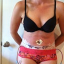 This is me 6 days after surgery from the front!  Again, I ignore the freaky parts and just think I look HOT!