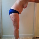 Pre-Op 4/3/11 -- UGH!!