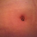 PO day 16. Close up of bb. Much smaller than I anticipated. Still has crusties so not sure what it will like in the end.