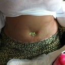 3 days post op