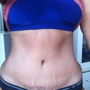 6 months post