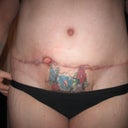 9 weeks po