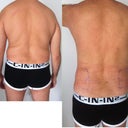 day 2 BACK VIEW , before and after