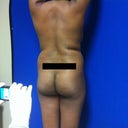 Preop