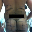 PREOP mARKUP