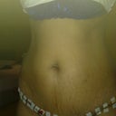 after 5hour surgery
