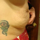 2 days before surgery