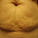 2 days before surgery