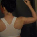 two days post op