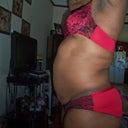 My left side 2 days pre-op.