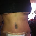3 weeks post op