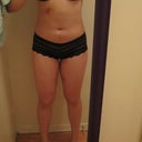 1 week post op