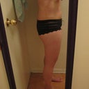 1 week post op