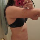 1 week post op