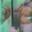 3 days Post Op