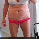 before you can see the scar above my belly button here and there's 2 scars below. (c section and laparotomy)