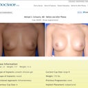 Kind of the look I'm looking for, says she is 275cc, but seems like implant brands are diff with the cc's when u look at size difference?