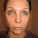 Before, no makeup