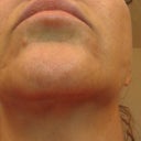Before, creapy skin all over.