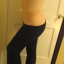 After/ 5 days post-op