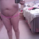 48 Hours post op.