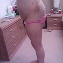 48 Hours post op.