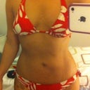 12 days post op front