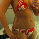 12 days post op 1/4